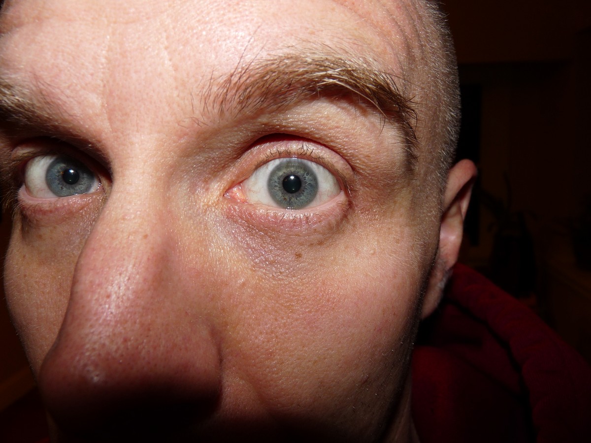 Closeup of a man’s eye